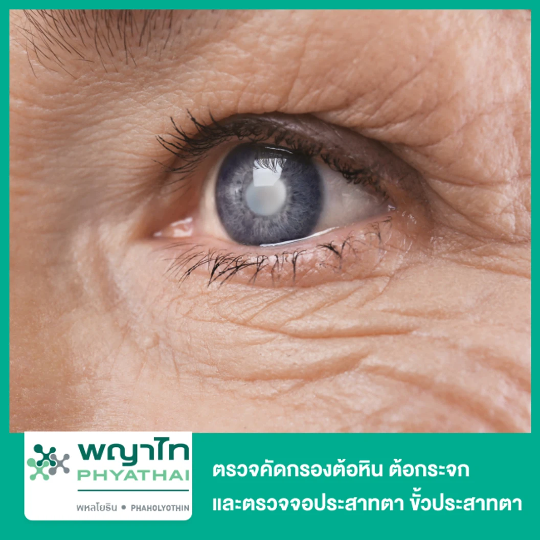 ตรวจคัดกรองต้อหิน ต้อกระจก ด้วยเทคโนโลยี OCT 2 จุด และตรวจจอประสาทตา ขั้วประสาทตาด้วยเครื่อง Fundus Camera