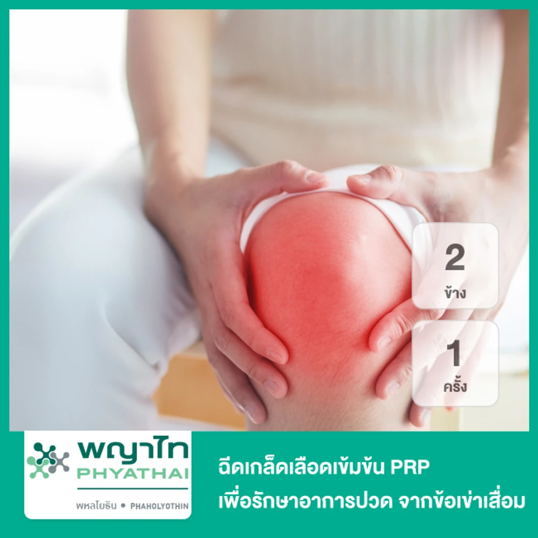ฉีดเกล็ดเลือดเข้มข้น PRP เพื่อรักษาอาการปวด จากข้อเข่าเสื่อม 2 ข้าง 1 ครั้ง