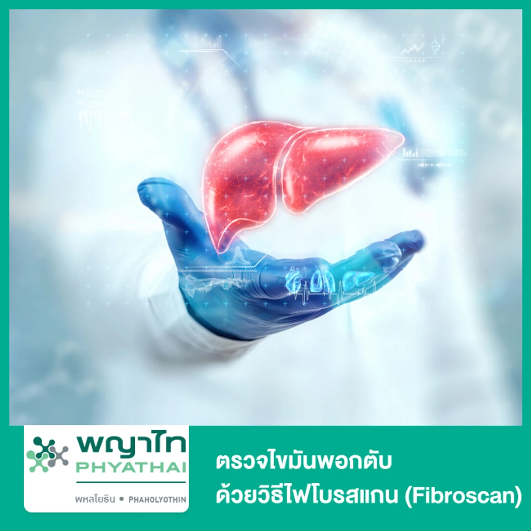 ตรวจไขมันพอกตับ ด้วยวิธีไฟโบรสแกน (Fibroscan)