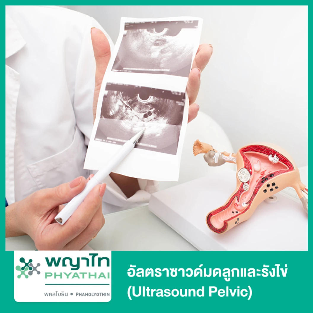 อัลตราซาวด์มดลูกและรังไข่ (Ultrasound Pelvic)