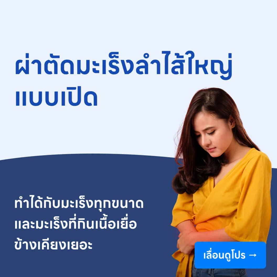 ผ่าตัดมะเร็งลำไส้ใหญ่ (แบบเปิด)