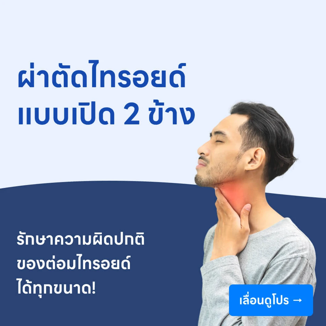 ผ่าตัดไทรอยด์ 2 ข้าง (แบบเปิด)