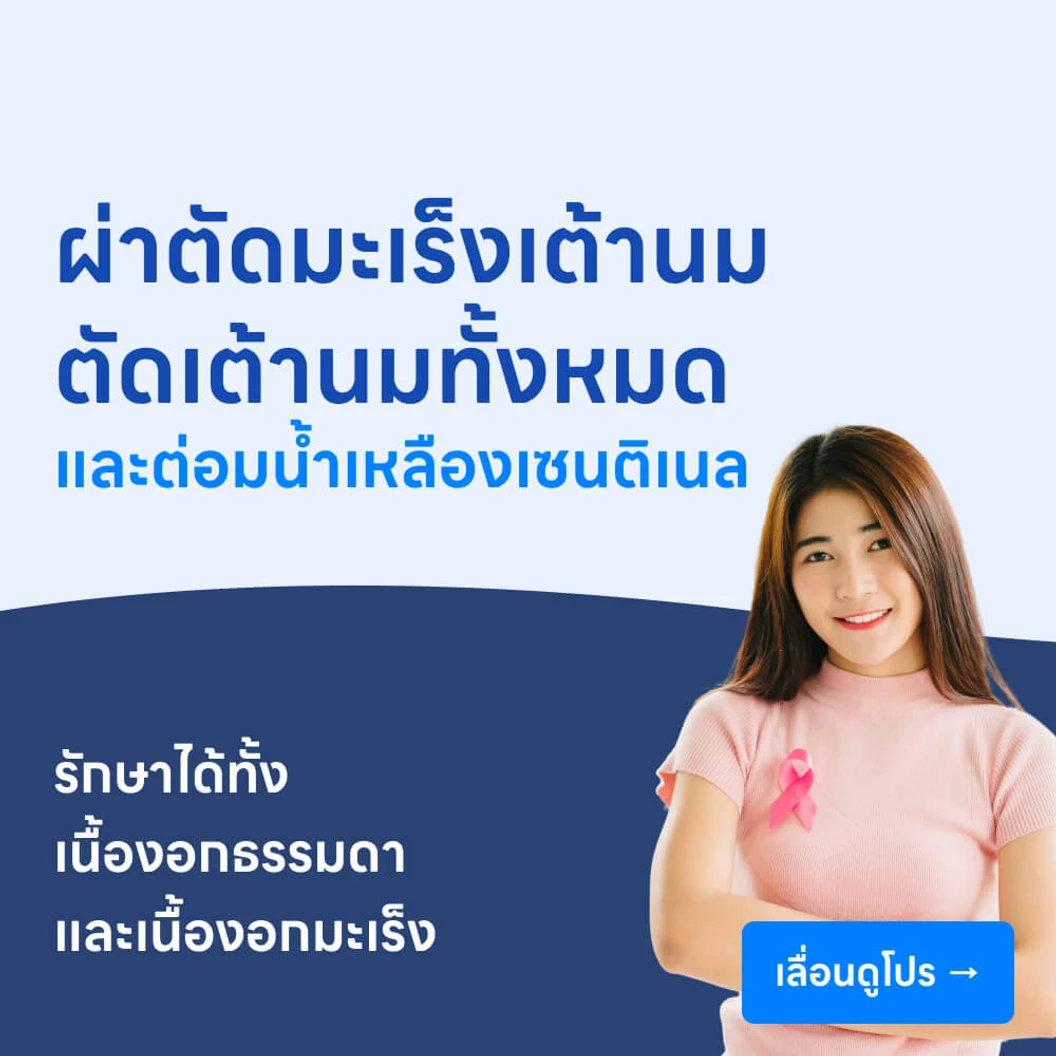 ผ่าตัดมะเร็งเต้านม ด้วยการตัดเต้านมทั้งหมด (แบบเปิด) พร้อมตัดต่อมน้ำเหลืองเซนติเนลออก (แบบเปิด)