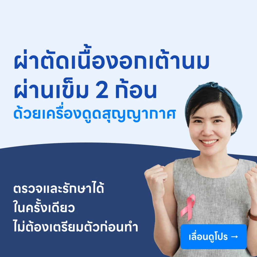 ผ่าตัดเนื้องอกเต้านมผ่านเข็ม ด้วยเครื่องเจาะดูดชิ้นเนื้อระบบสุญญากาศ (VAE) 2 ก้อน