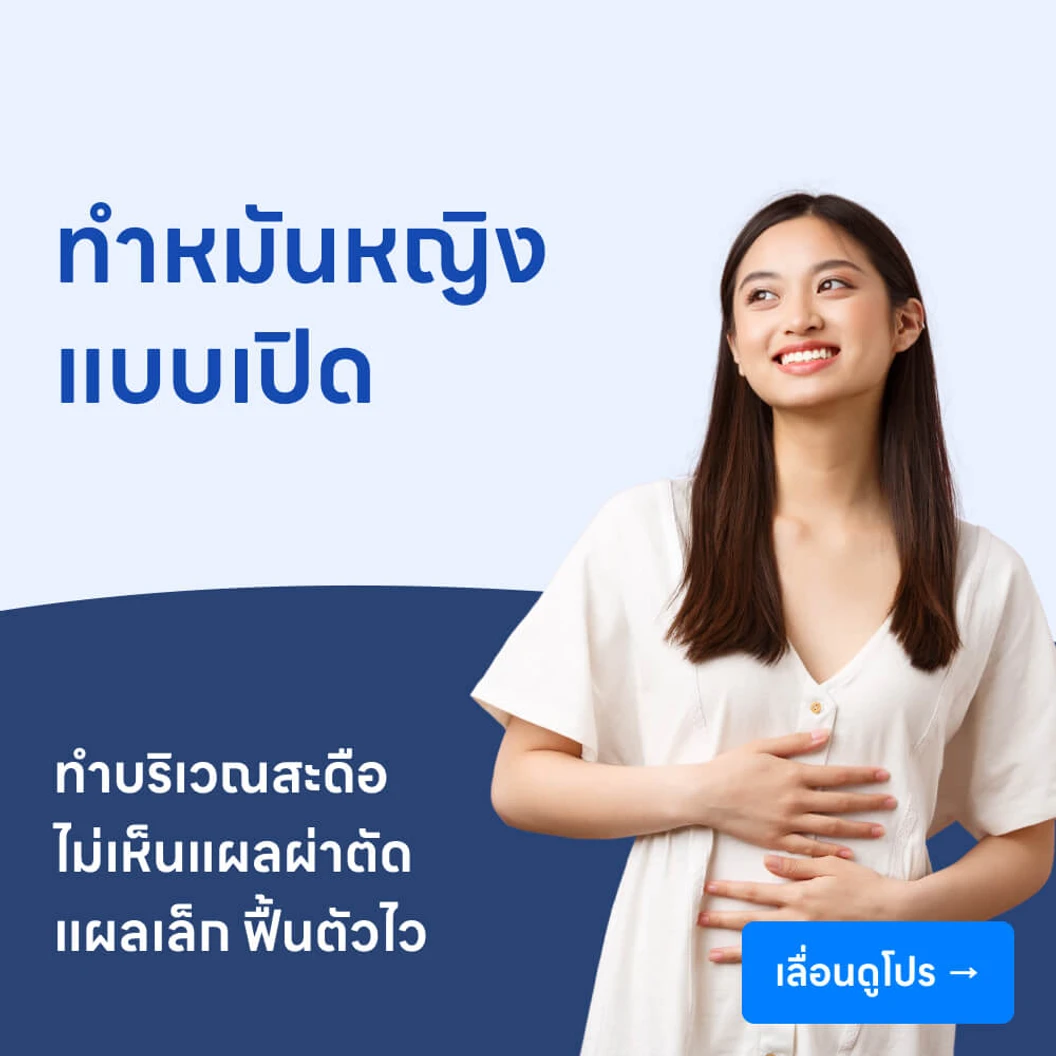 ทำหมันหญิงแบบเปิด