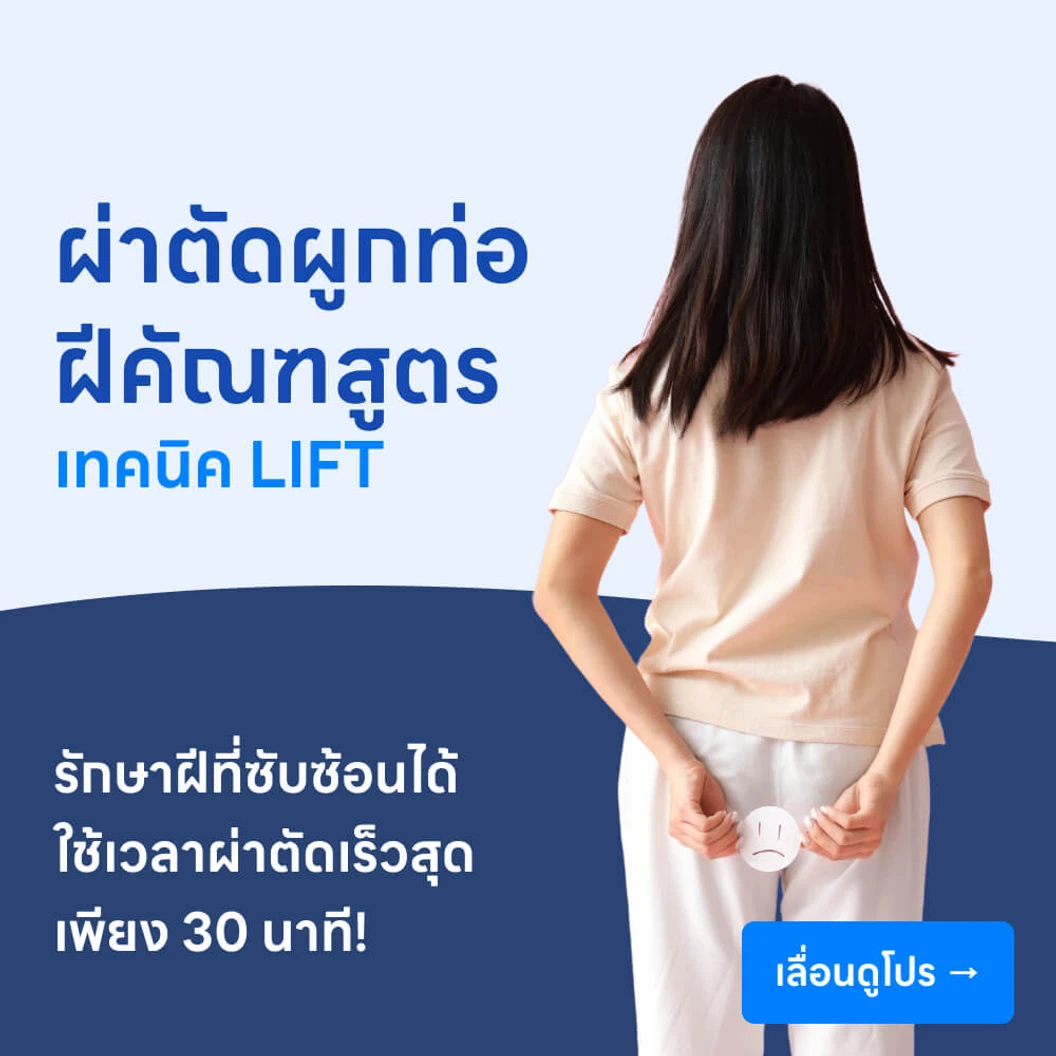 ผ่าตัดฝีคัณฑสูตร (ฝีที่ก้น) แบบไม่ตัดหูรูด เทคนิคผูกท่อ LIFT