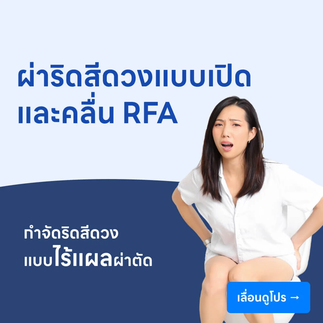 ผ่าตัดริดสีดวงทวารแบบเปิดและคลื่นความถี่สูง RFA