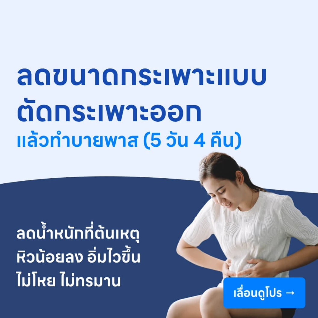 ผ่าตัดลดขนาดกระเพาะ แบบตัดกระเพาะออกแล้วทำบายพาส (5 วัน 4 คืน)