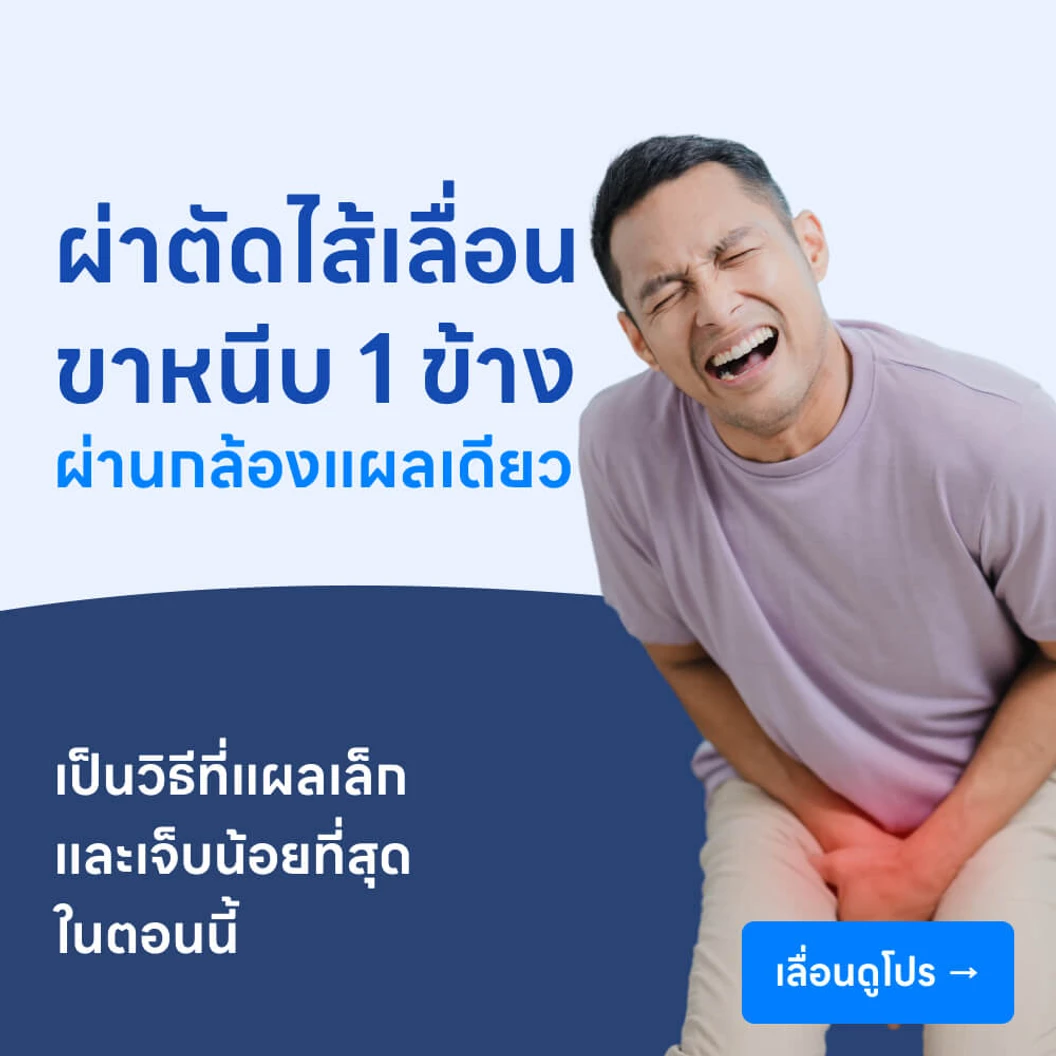 ผ่าตัดไส้เลื่อนขาหนีบ (แบบส่องกล้องแผลเดียว) // 1 ข้าง