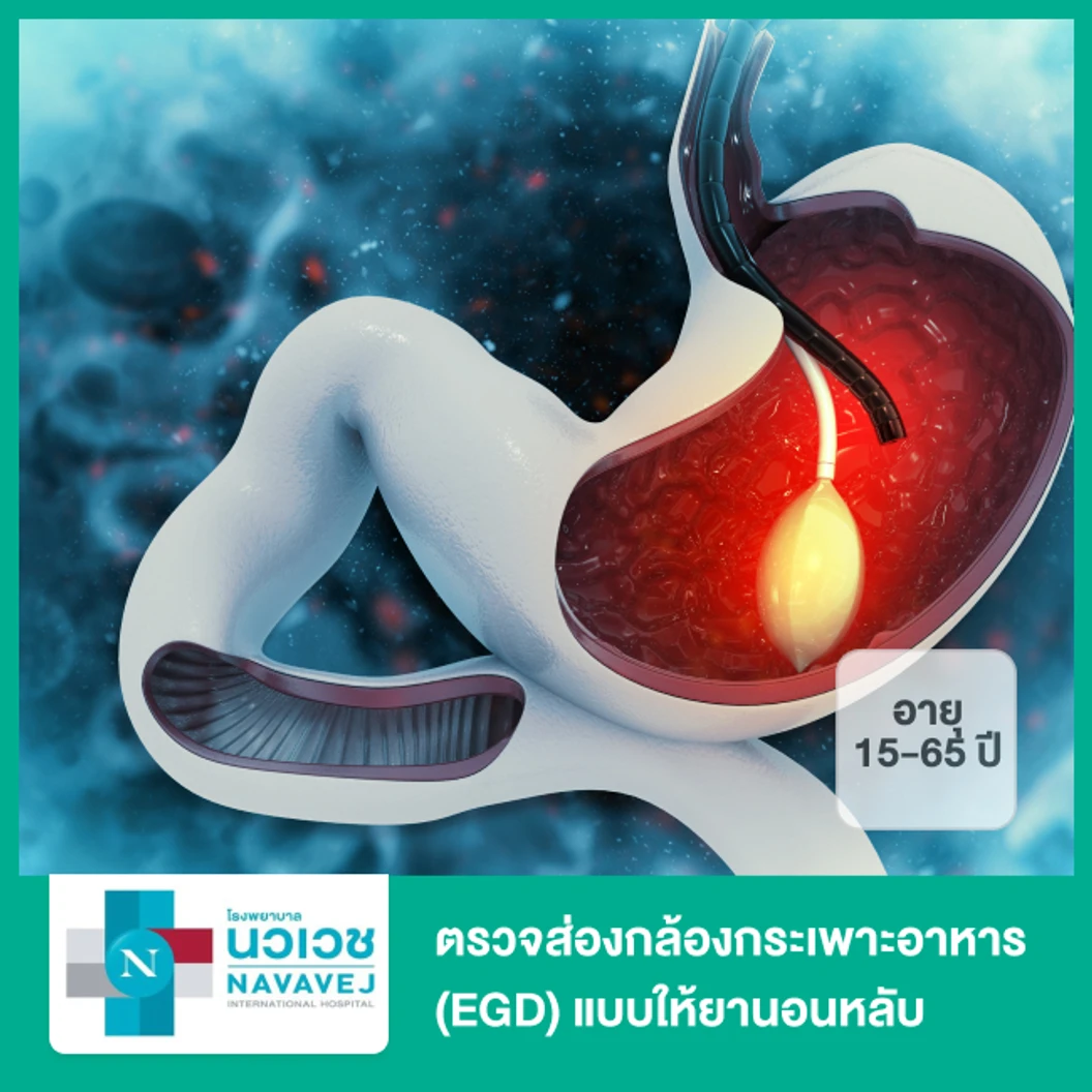 ตรวจส่องกล้องกระเพาะอาหาร (EGD) แบบให้ยานอนหลับ สำหรับผู้ที่อายุ 15-65 ปี
