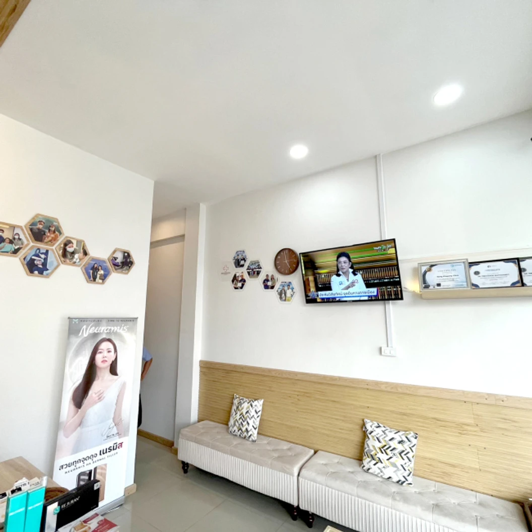 โปรแกรมโบท็อกซ์ จำนวนยูนิตขึ้นอยู่กับแพทย์ประเมิน (ตีนกา + หางตา)