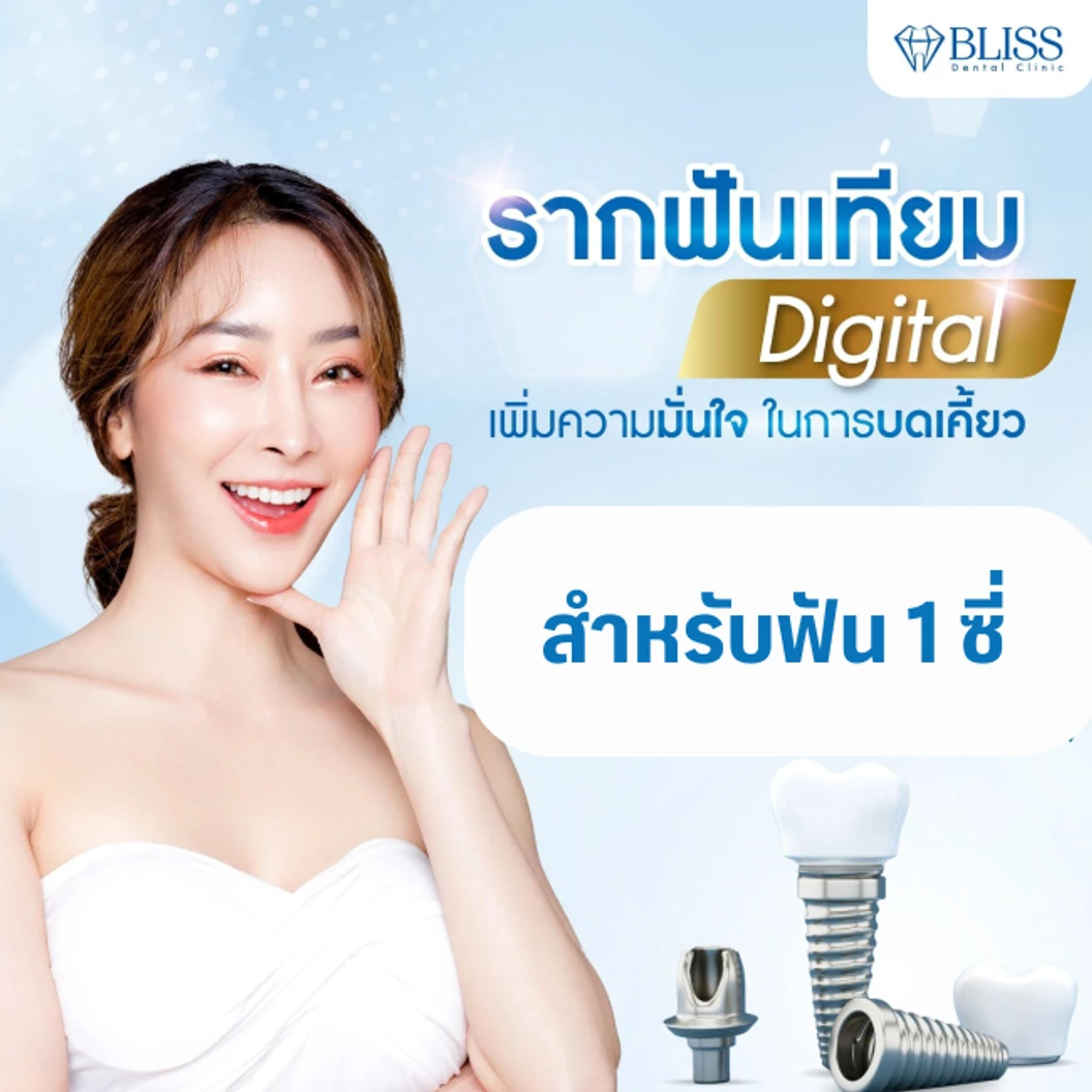 ทำรากฟันเทียมยี่ห้อ Osstem สำหรับฟัน 1 ซี่