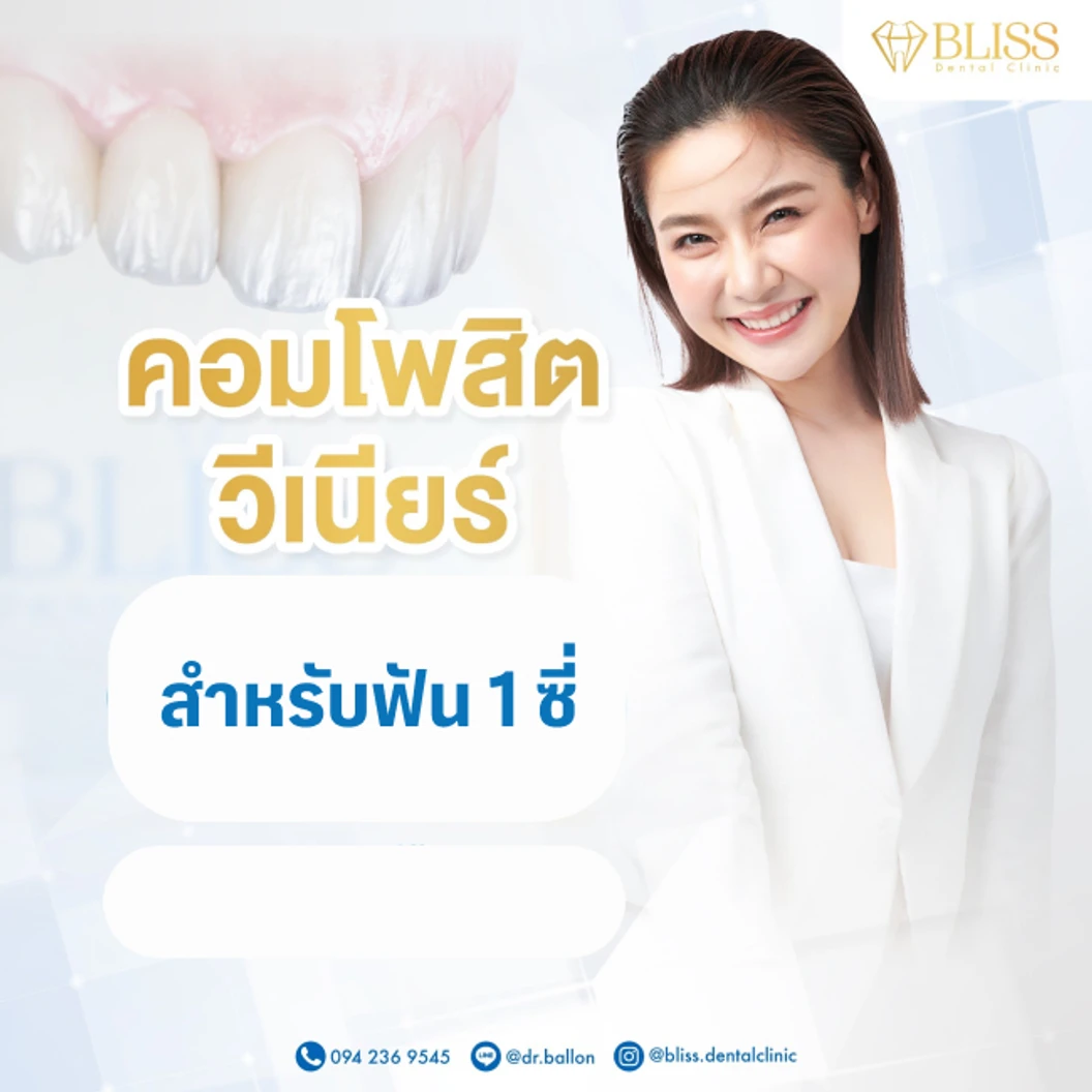 เคลือบผิวฟันและแปะฟันขาว ด้วยวีเนียร์คอมโพสิต 1 ซี่