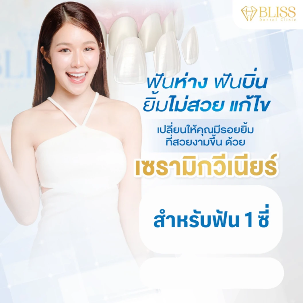 เคลือบผิวฟันและแปะฟันขาว ด้วยวีเนียร์เซรามิก 1 ซี่