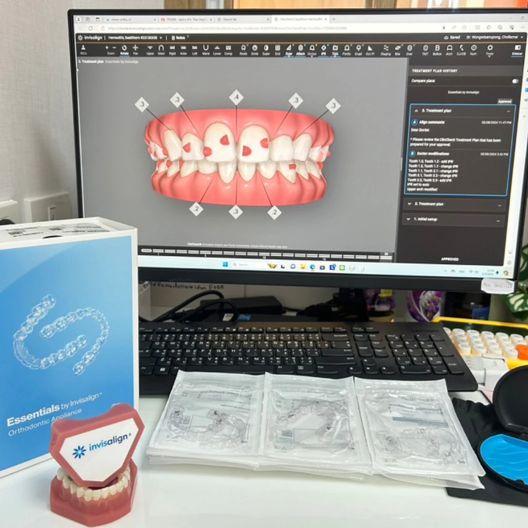 จัดฟันแบบใส Invisalign Essential ฟันบนและล่าง