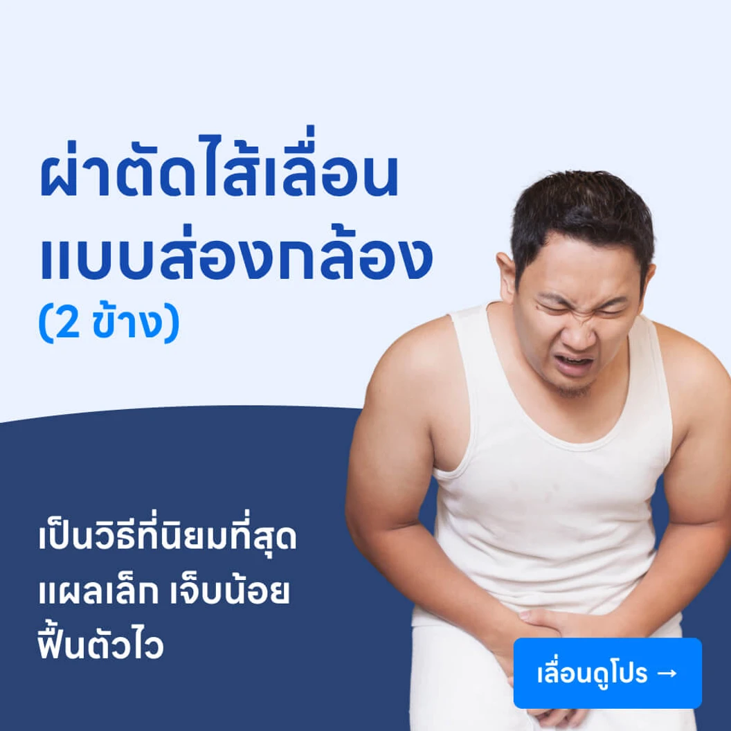 ผ่าตัดไส้เลื่อน (แบบส่องกล้อง) // 2 ข้าง