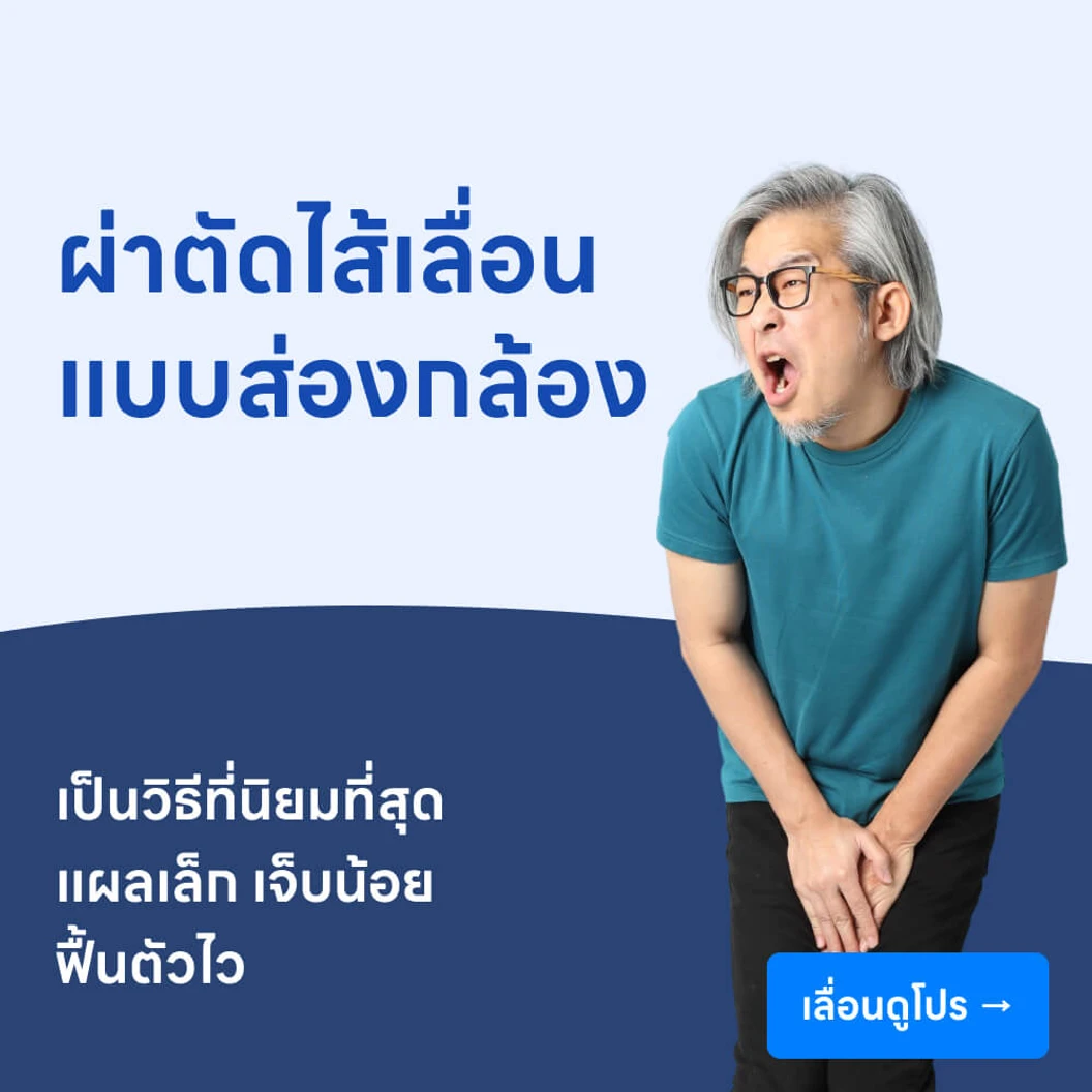 ผ่าตัดไส้เลื่อน (แบบส่องกล้อง)