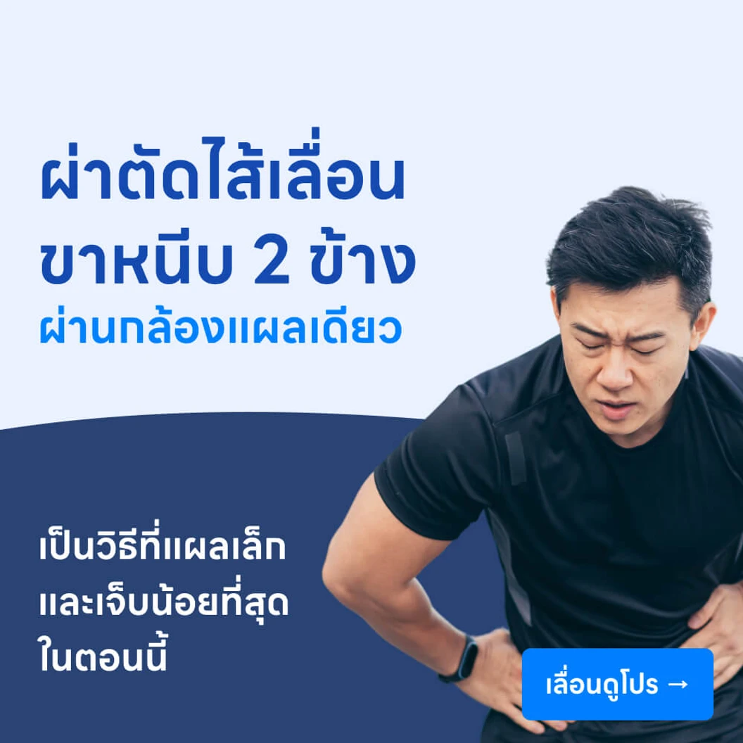 ผ่าตัดไส้เลื่อนขาหนีบ (แบบส่องกล้องแผลเดียว) // 2 ข้าง