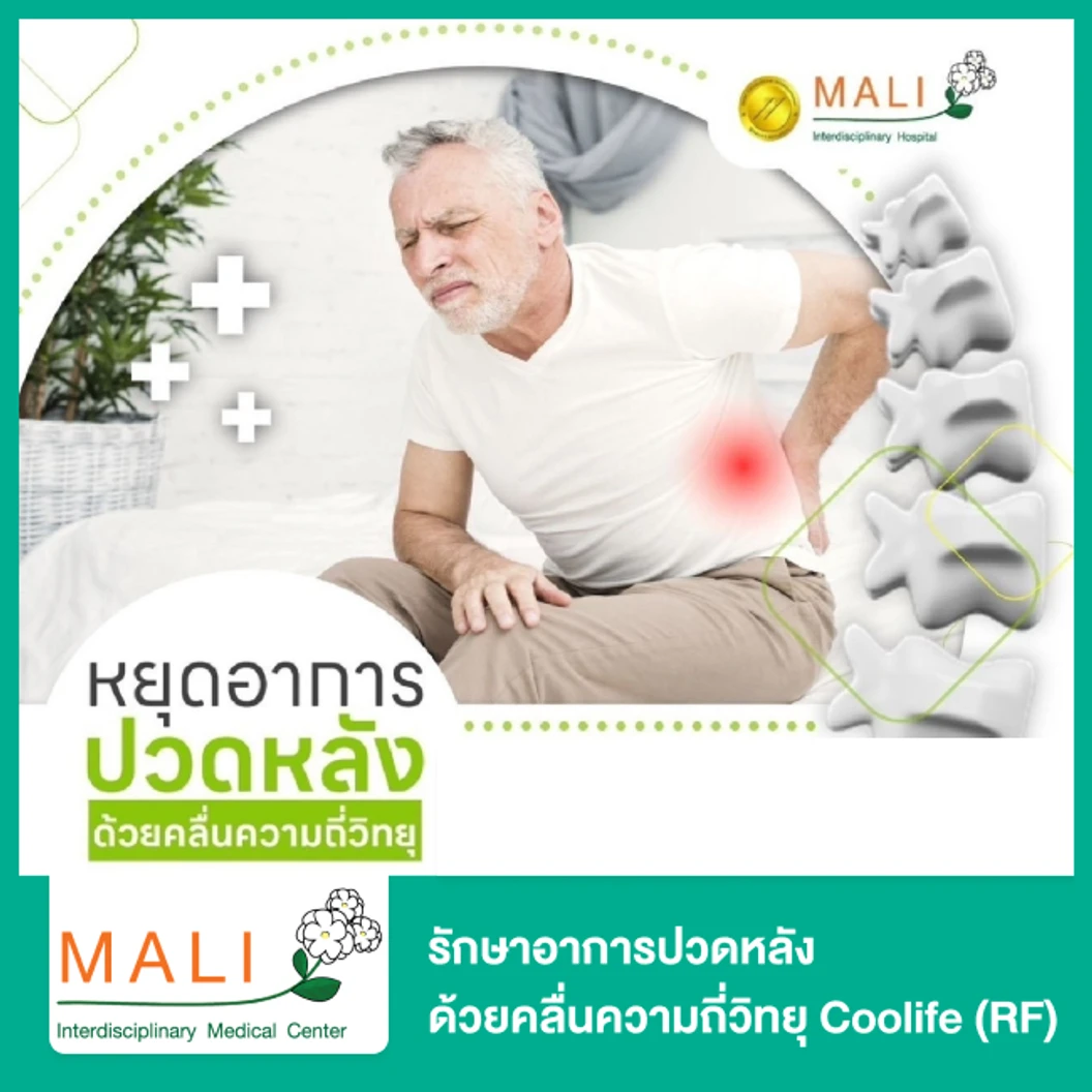 รักษาอาการปวดหลัง ด้วยคลื่นความถี่วิทยุ Coolife (RF)