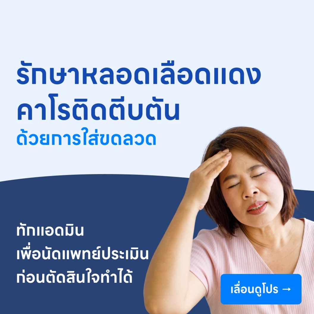 รักษาโรคหลอดเลือดแดงคาโรติดตีบตัน ด้วยการใส่ขดลวด