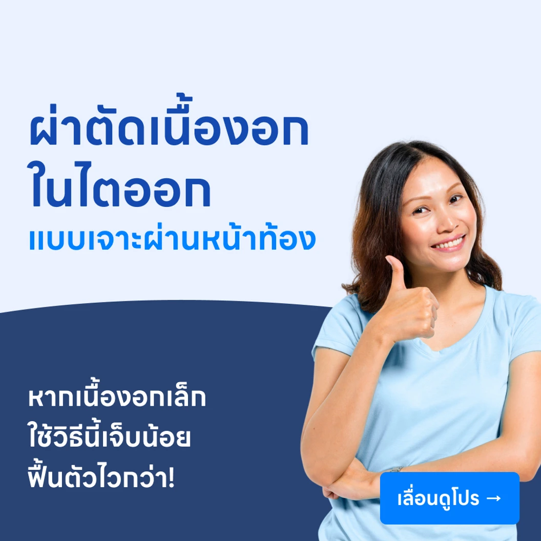 ผ่าตัดเนื้องอกในไตออก (แบบเจาะผ่านหน้าท้อง)