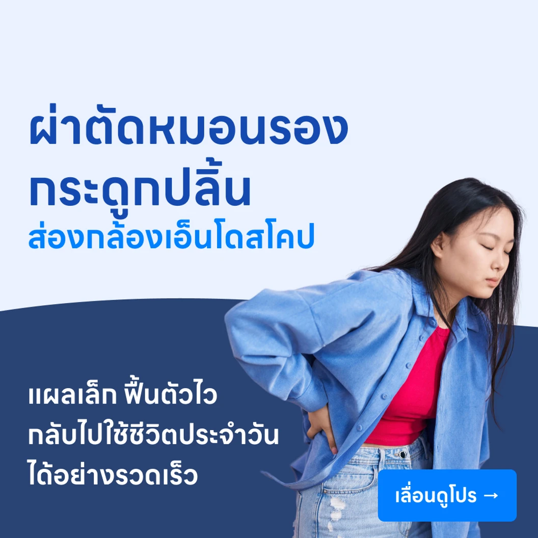 ผ่าตัดหมอนรองกระดูกปลิ้น (แบบส่องกล้องเอ็นโดสโคป)