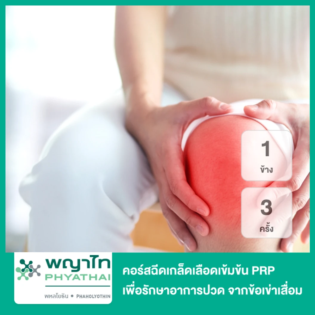 คอร์สฉีดเกล็ดเลือดเข้มข้น PRP เพื่อรักษาอาการปวด จากข้อเข่าเสื่อม 1 ข้าง 3 ครั้ง