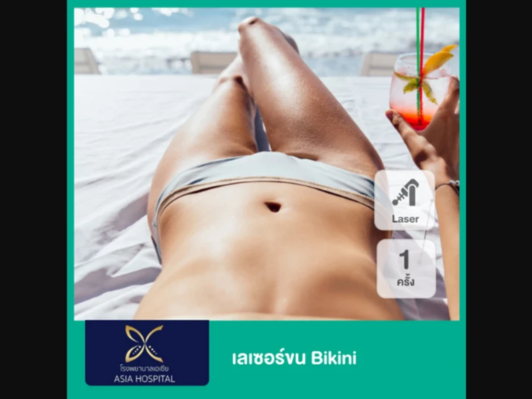 กำจัดขน Bikini ด้วย SHR Laser 1 ครั้ง สำหรับผู้หญิงเท่านั้น