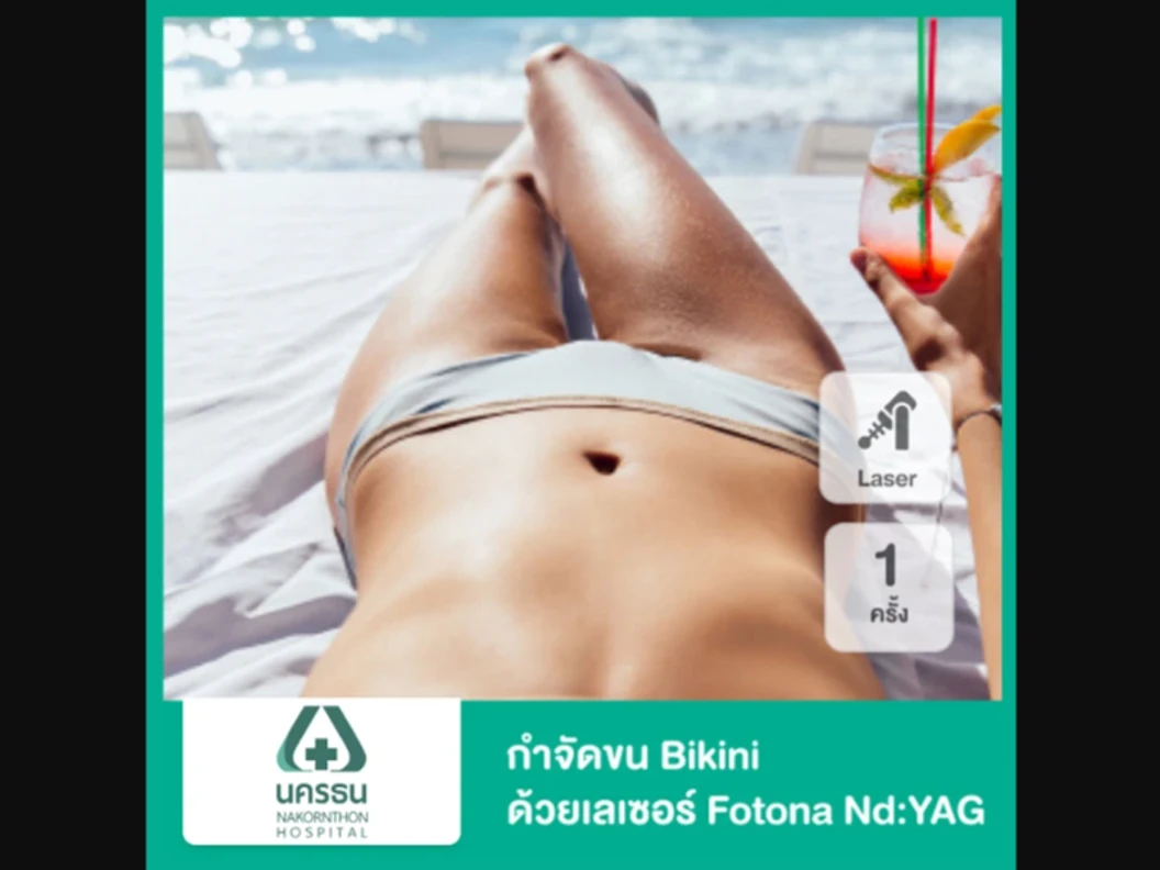 กำจัดขน Bikini ด้วย Fotona Nd:YAG Laser 1 ครั้ง สำหรับผู้หญิงหรือผู้ชาย