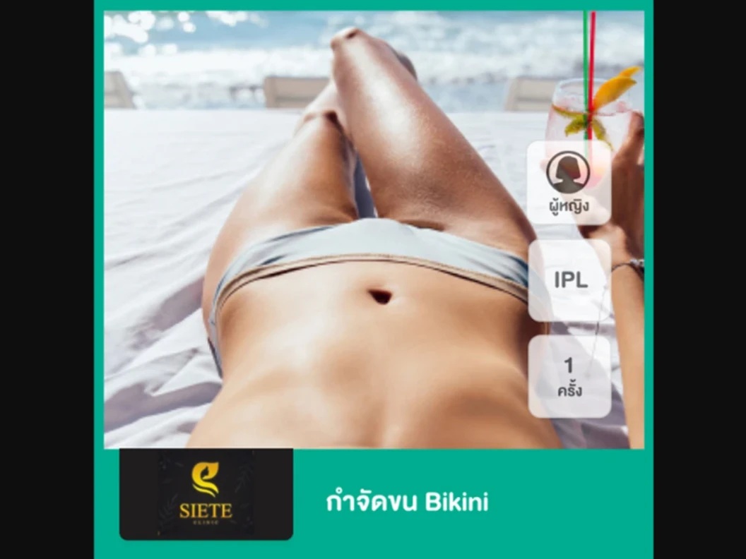 กำจัดขน Bikini ด้วย IPL 1 ครั้ง สำหรับผู้หญิงเท่านั้น