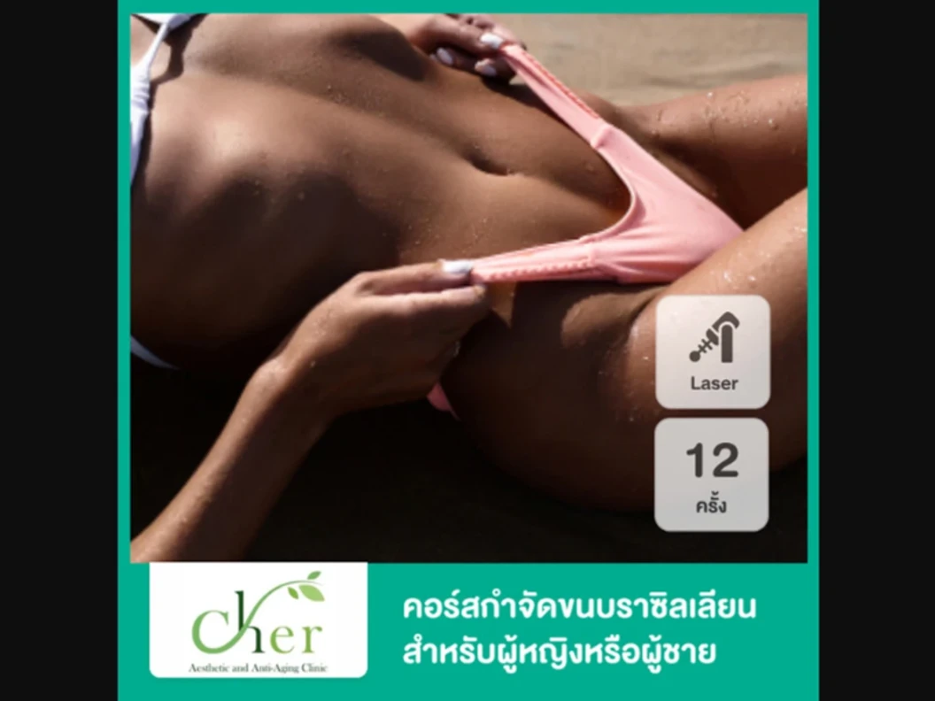 คอร์สกำจัดขน Brazilian ด้วย Diode Laser 12 ครั้ง ภายใน 1 ปี สำหรับผู้ชายเท่านั้น