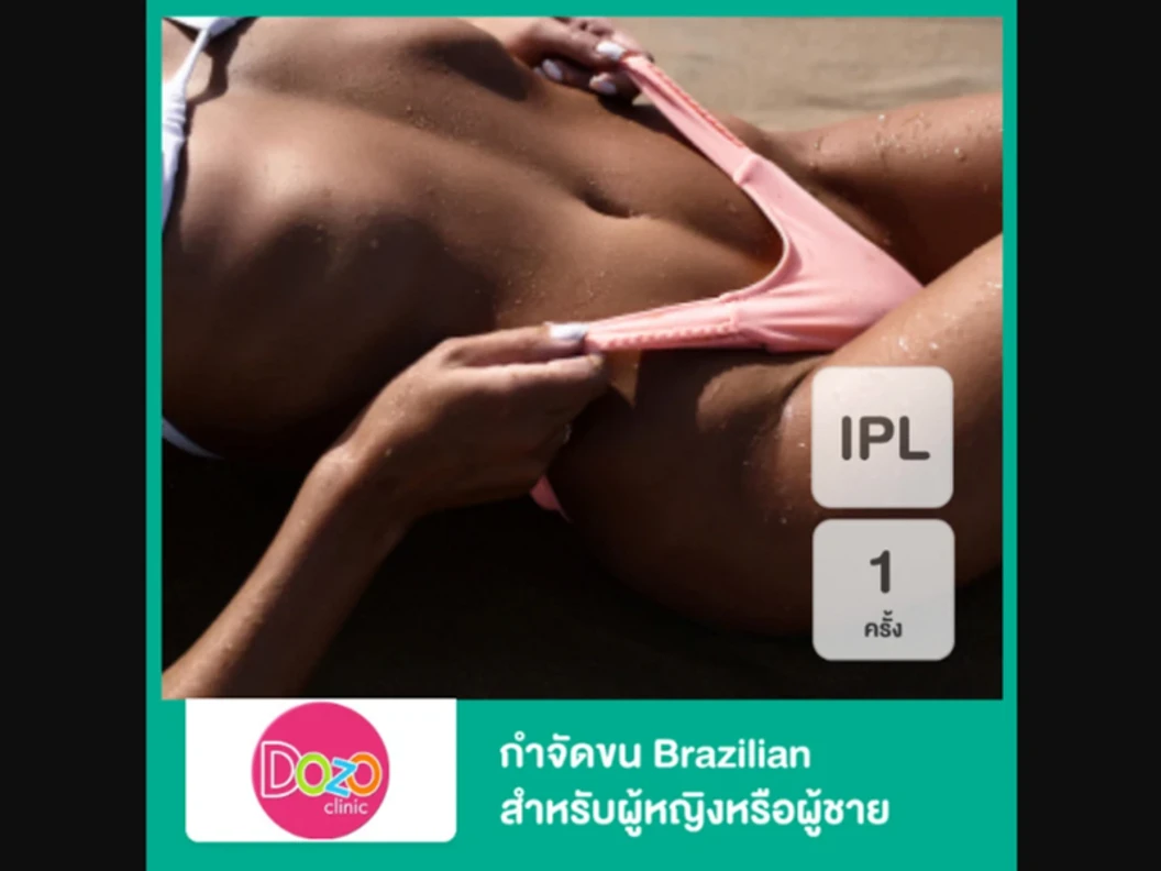 กำจัดขน Brazilian ด้วย IPL 1 ครั้ง สำหรับผู้หญิงหรือผู้ชาย