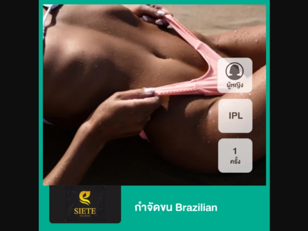 กำจัดขน Brazilian ด้วย IPL 1 ครั้ง สำหรับผู้หญิงเท่านั้น