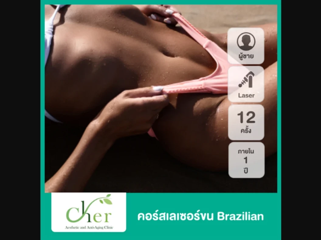 คอร์สกำจัดขน Brazilian ด้วย Diode Laser 10 ครั้ง ภายใน 1 ปี สำหรับผู้ชายเท่านั้น