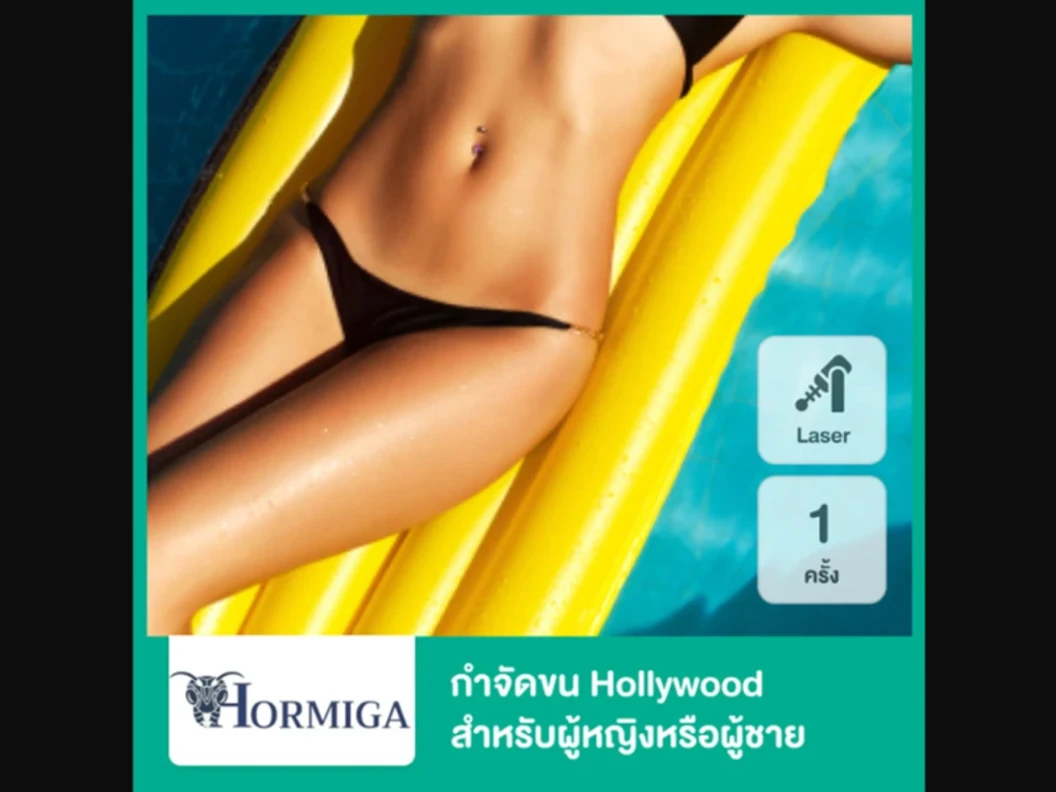 กำจัดขน Hollywood ด้วย Diode Laser 1 ครั้ง สำหรับผู้หญิงหรือผู้ชาย