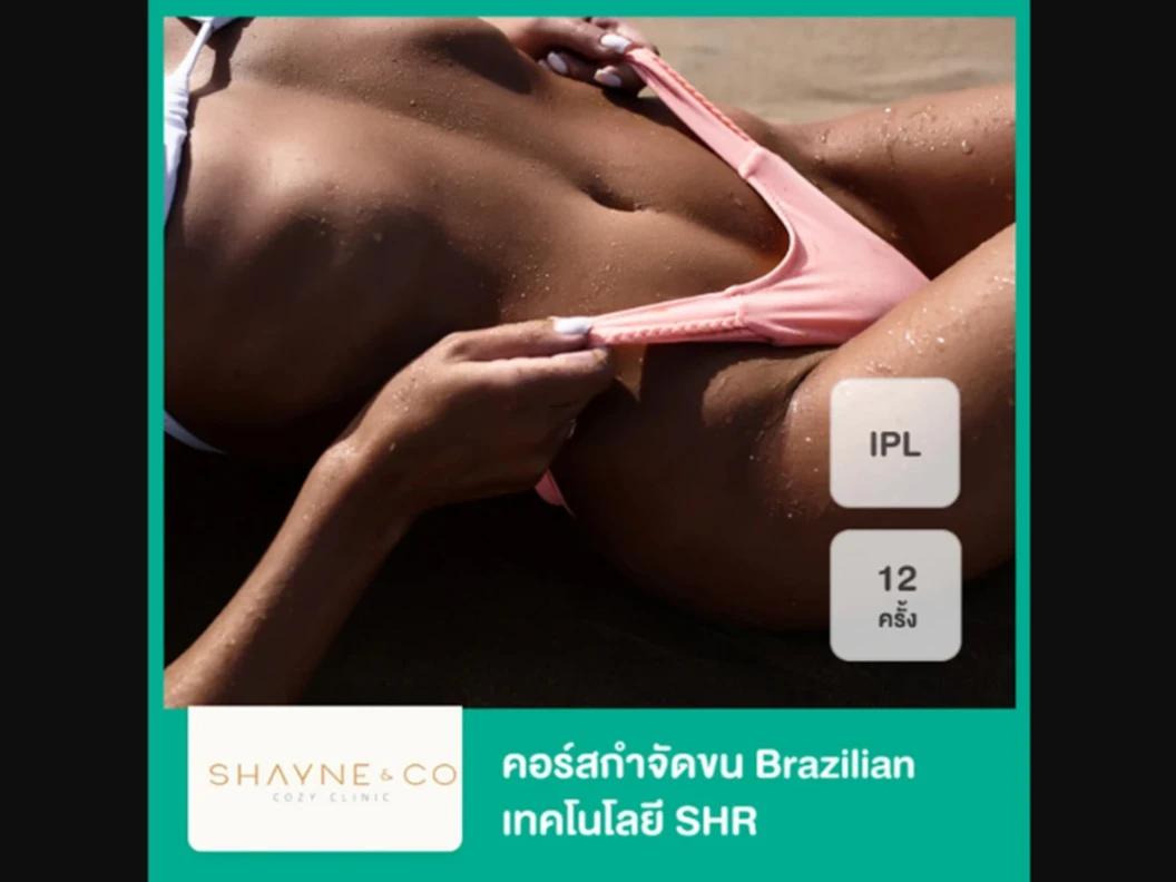 คอร์สกำจัดขน Brazilian ด้วยเลเซอร์ SHR 12 ครั้ง ภายใน 1 ปี สำหรับผู้หญิงหรือผู้ชาย