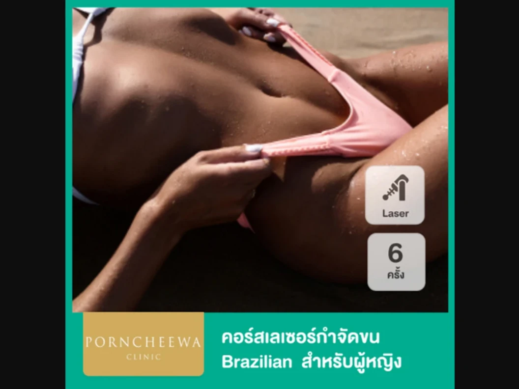 คอร์สกำจัดขน Brazilian ด้วยเลเซอร์ Premium Ice Diode 6 ครั้ง สำหรับผู้หญิงเท่านั้น