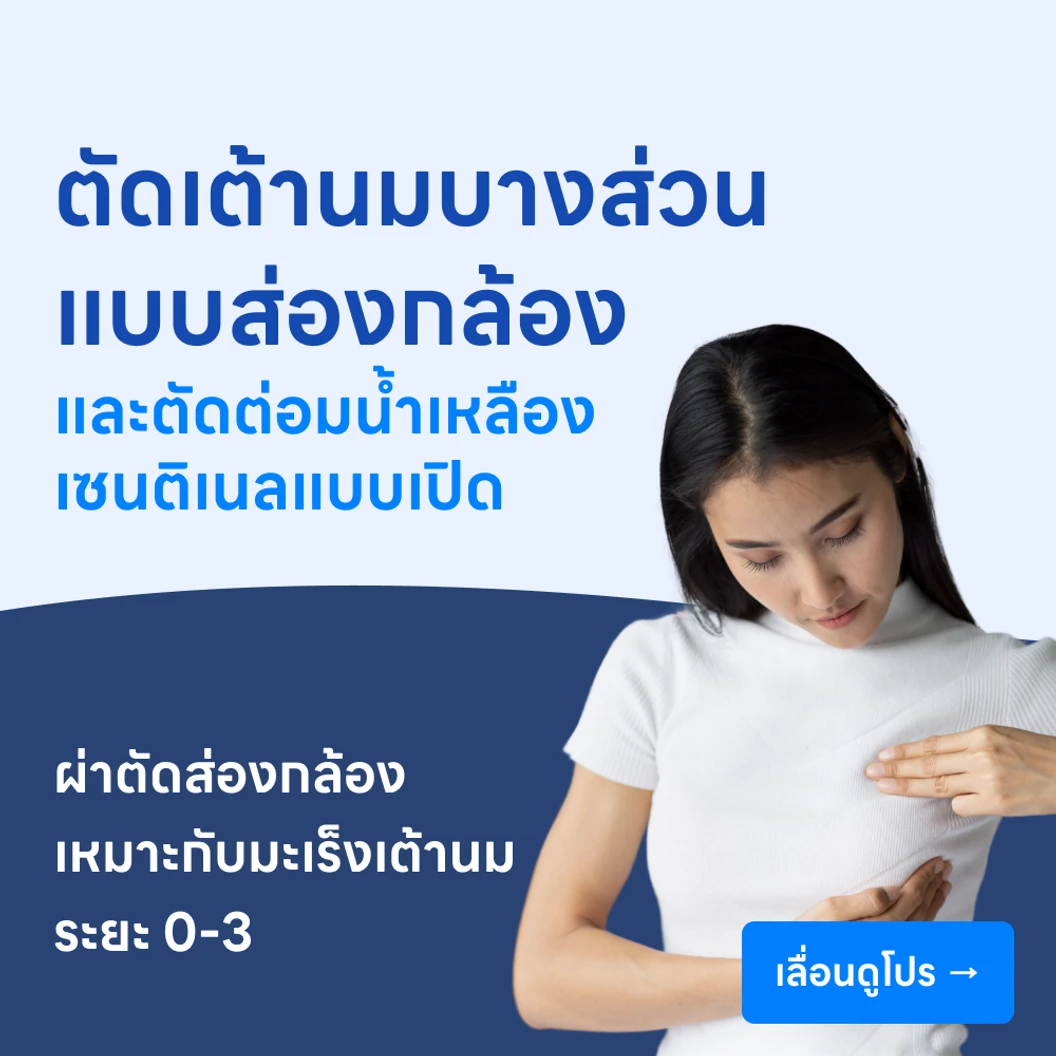 ผ่าตัดเต้านมออกเพียงบางส่วนแบบส่องกล้อง +ผ่าตัดต่อมน้ำเหลืองเซนติเนลแบบเปิด