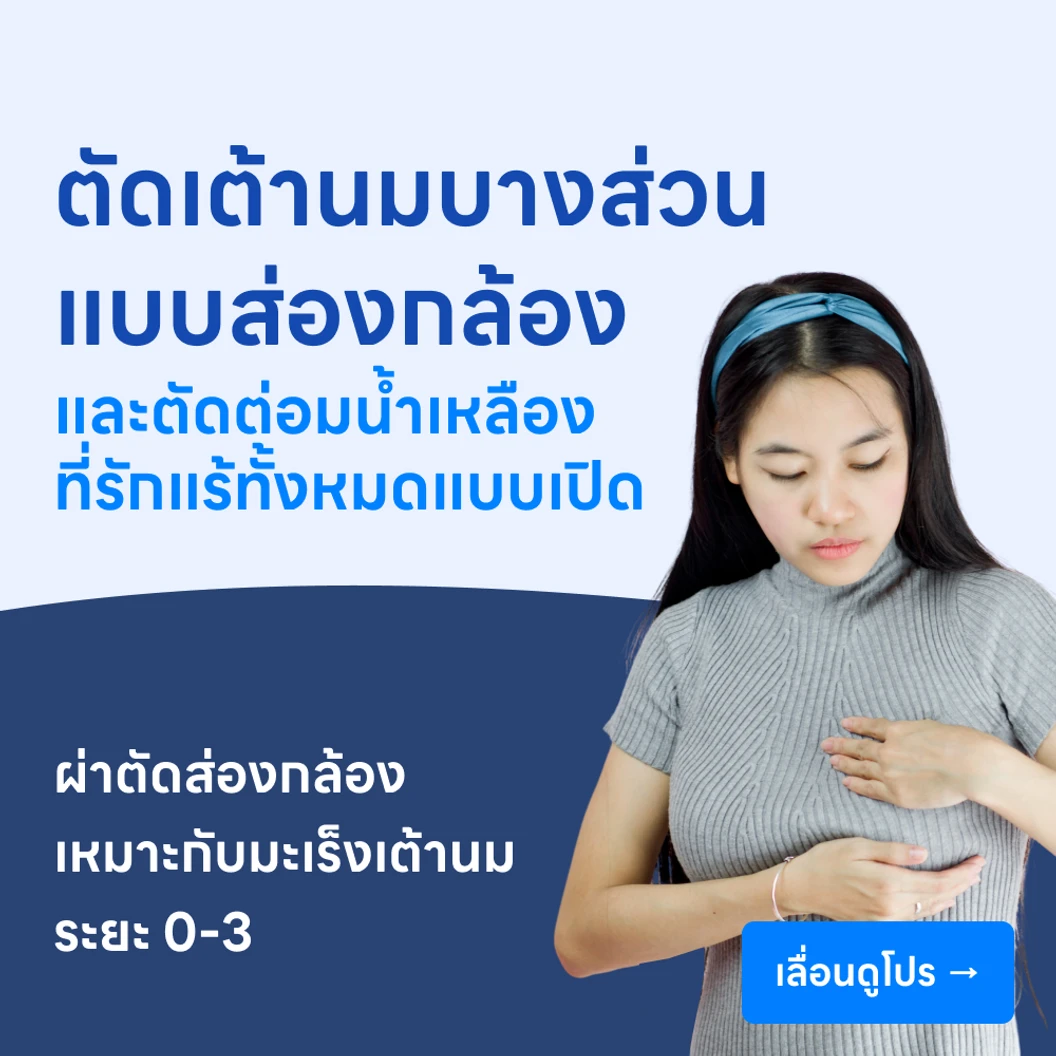 ผ่าตัดเต้านมออกเพียงบางส่วนแบบส่องกล้อง +ผ่าตัดต่อมน้ำเหลืองที่รักแร้ออกทั้งหมดแบบเปิด