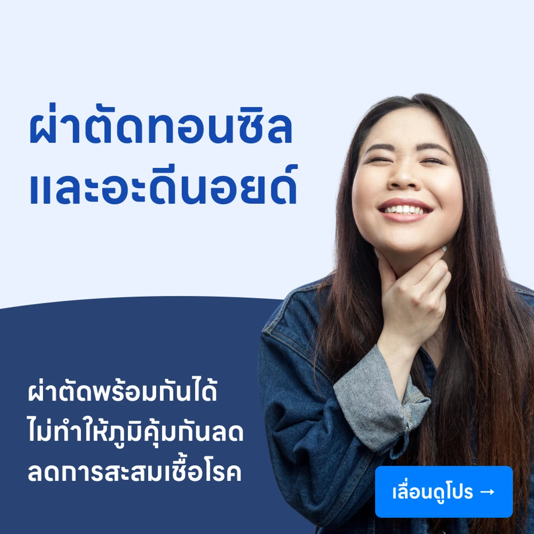 ผ่าตัดทอนซิลและอะดีนอยด์