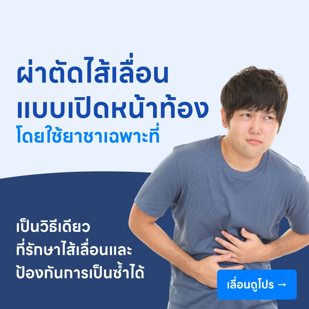 ผ่าตัดซ่อมแซมไส้เลื่อนแบบเปิดหน้าท้อง โดยใช้ยาชาเฉพาะที่