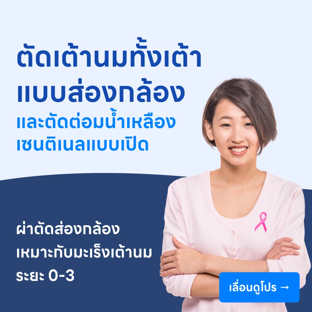 ผ่าตัดเต้านมออกทั้งเต้าแบบส่องกล้อง + เสริมสร้างเต้านมด้วยซิลิโคน +ผ่าตัดต่อมน้ำเหลืองเซนติเนลแบบเปิด