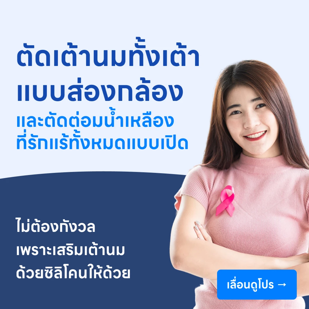 ผ่าตัดเต้านมออกทั้งเต้าแบบส่องกล้อง + เสริมสร้างเต้านมด้วยซิลิโคน +ผ่าตัดต่อมน้ำเหลืองที่รักแร้ออกทั้งหมดแบบเปิด