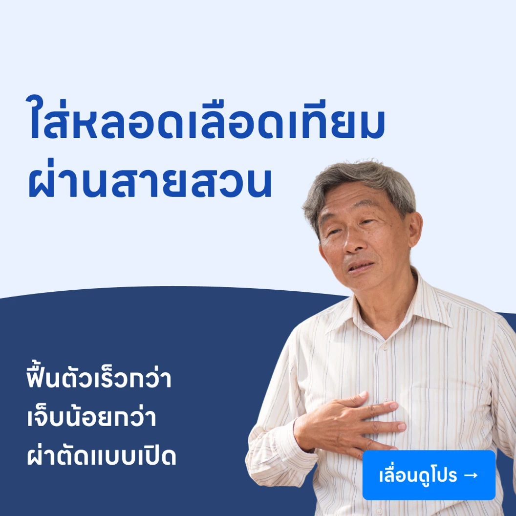 ผ่าตัดสอดใส่หลอดเลือดเทียมผ่านสายสวน