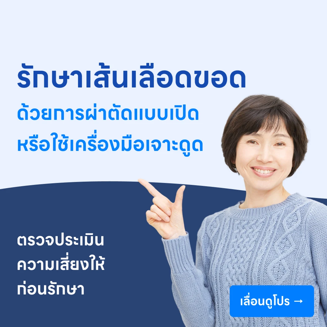 ผ่าตัดรักษาเส้นเลือดขอดที่ขา