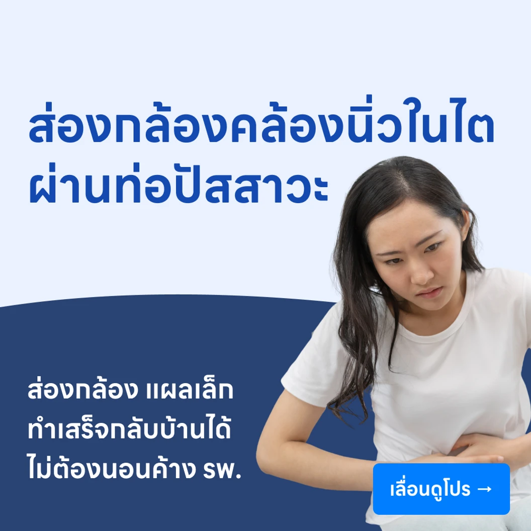 สลายนิ่ว ด้วยวิธีส่องกล้องคล้องนิ่วในไต (ผ่านท่อปัสสาวะ)