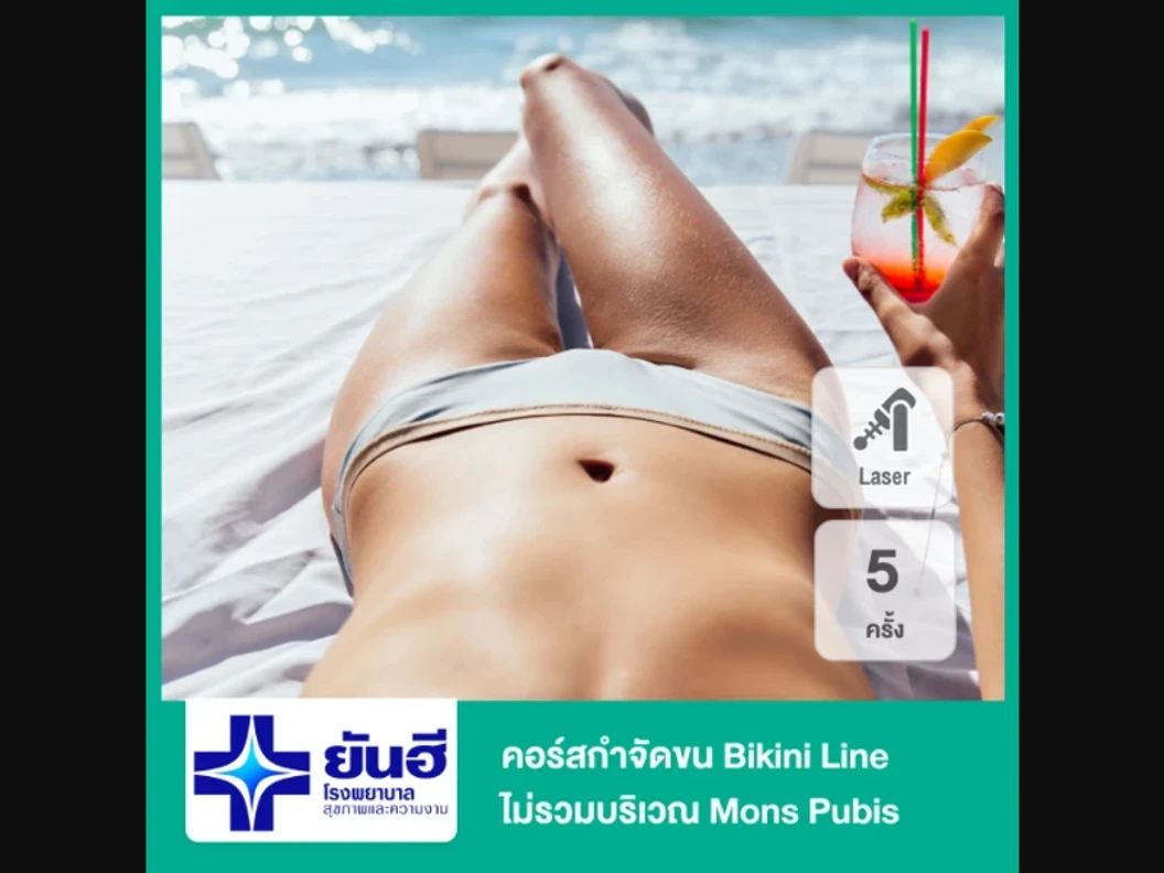 คอร์สกำจัดขน Bikini Line ไม่รวมบริเวณ Mons Pubis ด้วย Diode Laser รุ่น Soprano ICE Platinum 5 ครั้ง สำหรับผู้หญิงหรือผู้ชาย