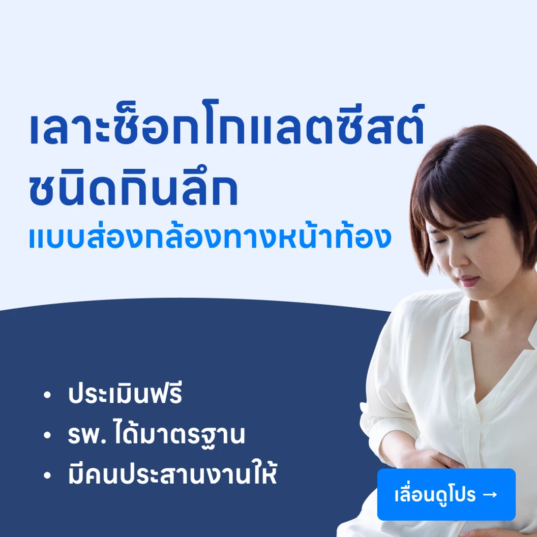 ผ่าตัดเลาะส่องกล้องทางหน้าท้องเพื่อเลาะตัดรอยโรคช็อกโกแลตซีสต์ชนิดกินลึก