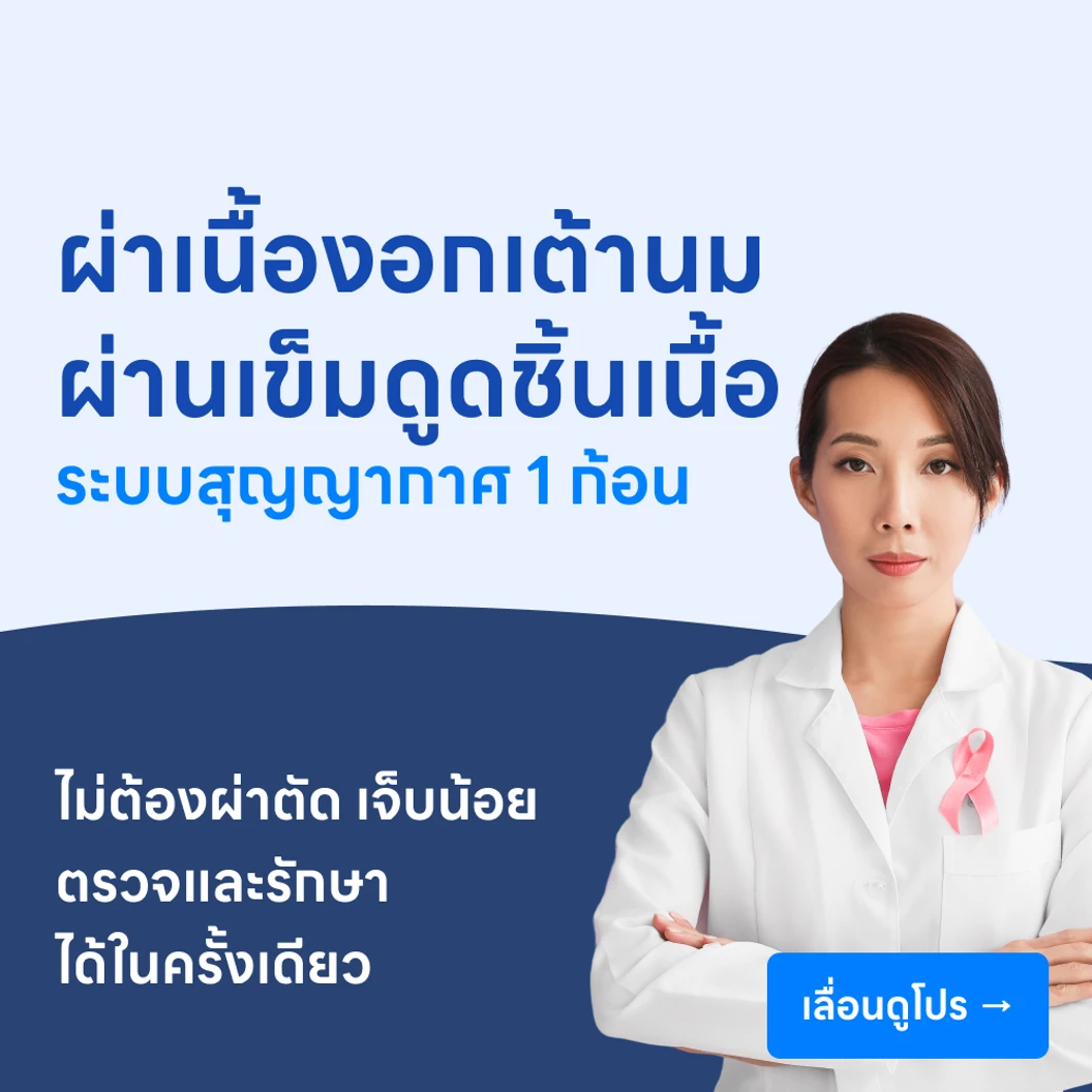 ผ่าตัดเนื้องอกเต้านมผ่านเข็ม ด้วยเครื่องเจาะดูดชิ้นเนื้อระบบสุญญากาศ (VAE) 1 ก้อน