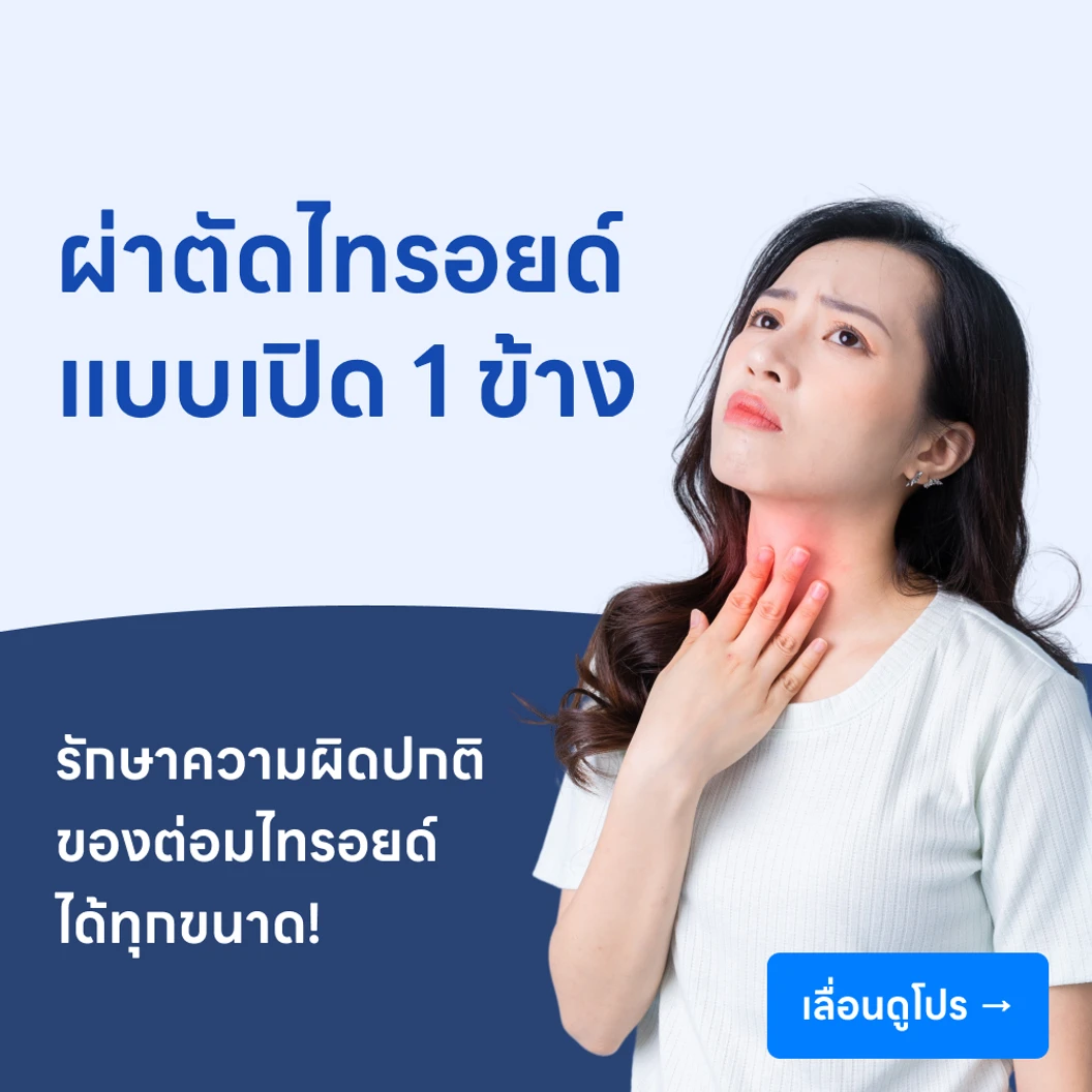 ผ่าตัดไทรอยด์ แบบเปิด (Open Subtotal Thyroidectomy)